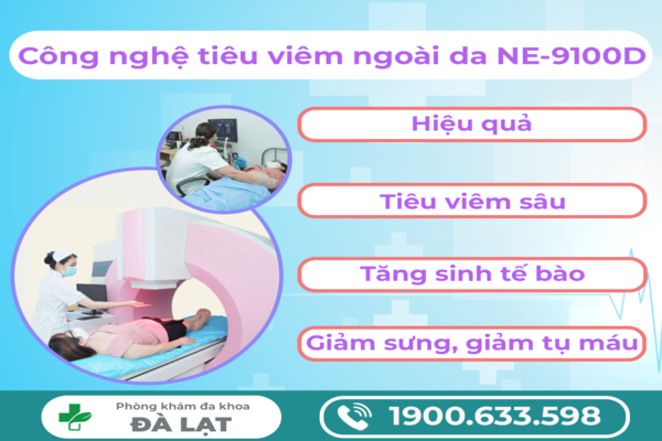 Hình ảnh minh họa